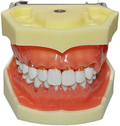 KH66ZKY מחלת חניכיים מודל שיניים - מודל דנטלי דונט - מיתון חניכי
